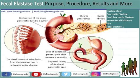 Elastaza pancreatică în materii fecale